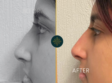 treatments inner thumb1