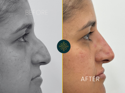 treatments inner thumb1